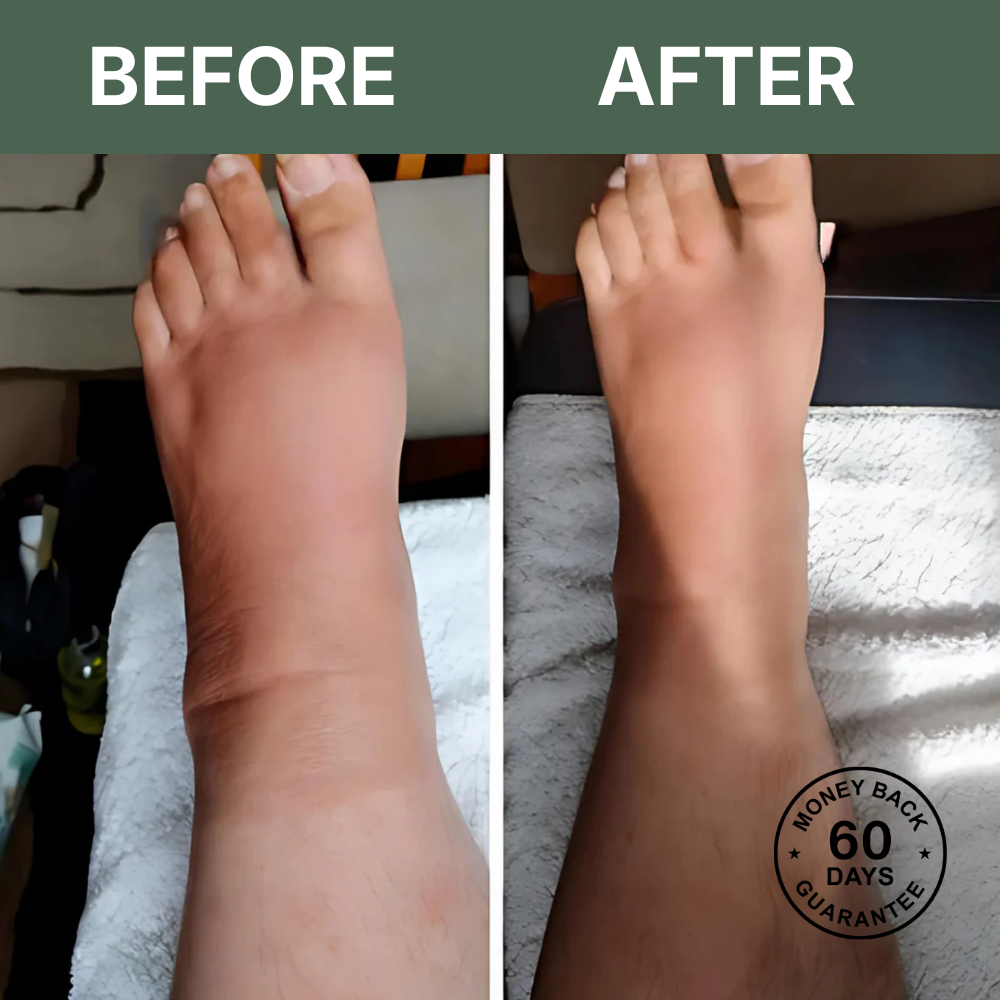 LymphaFlow™ Pro – Natural Relief for Swollen Legs In Just 15 Minutes A Day!