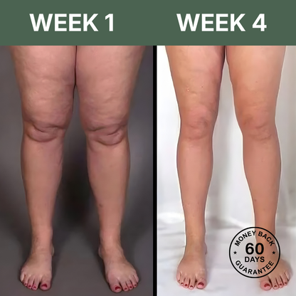 LymphaFlow™ Pro – Natural Relief for Swollen Legs In Just 15 Minutes A Day!